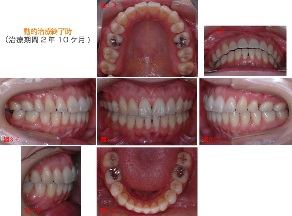 動的治療終了時