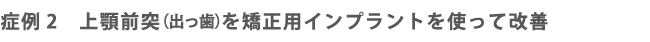 症例2上顎前突(出っ歯）を矯正用インプラントを使って改善した症例