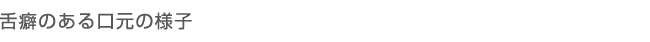 舌癖のある口元の様子